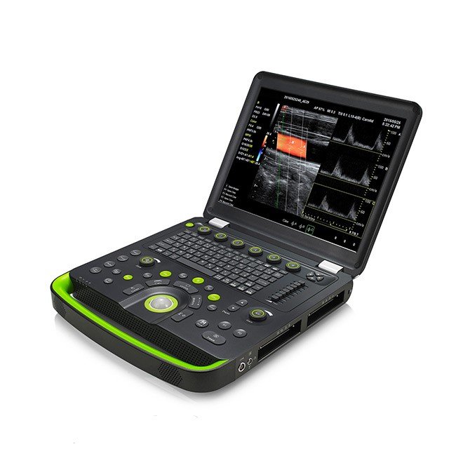 Static 3D/4D Doppler Ultrasound NEUCU56