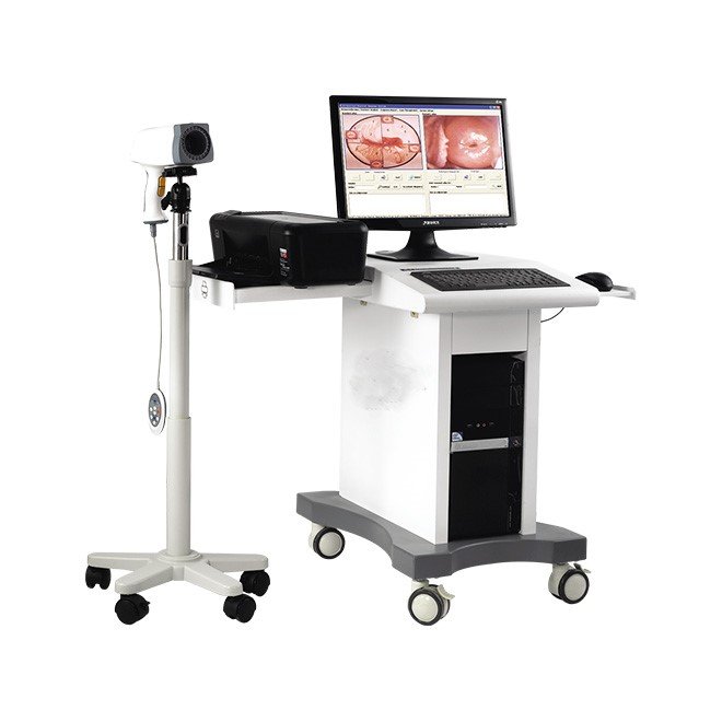 Colposcope Video Machine for Gynaecology NEUCE06